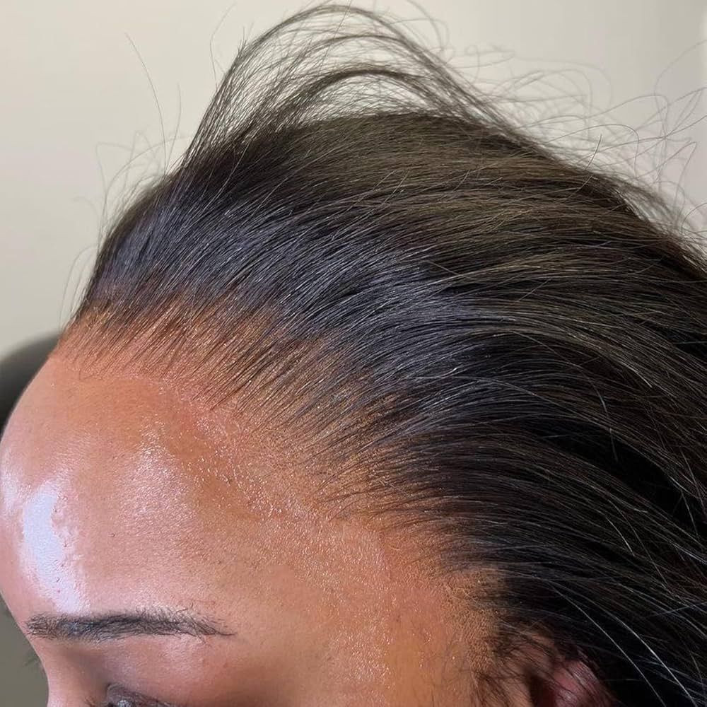 lagos hairline