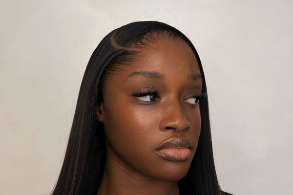 lagos hairline