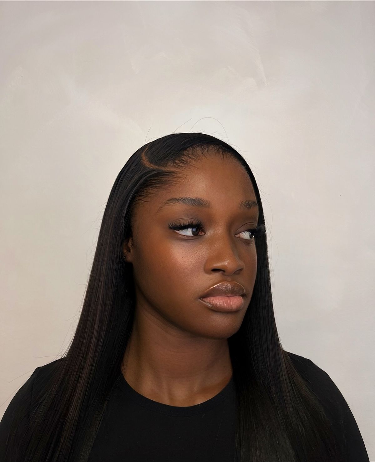 lagos hairline