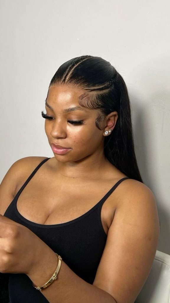 lagos hairline